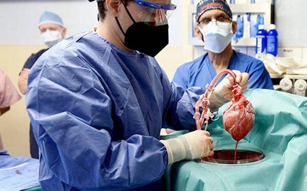 The Baltimore Pig-to-Human Heart Transplant: What Does it mean for the Future?
